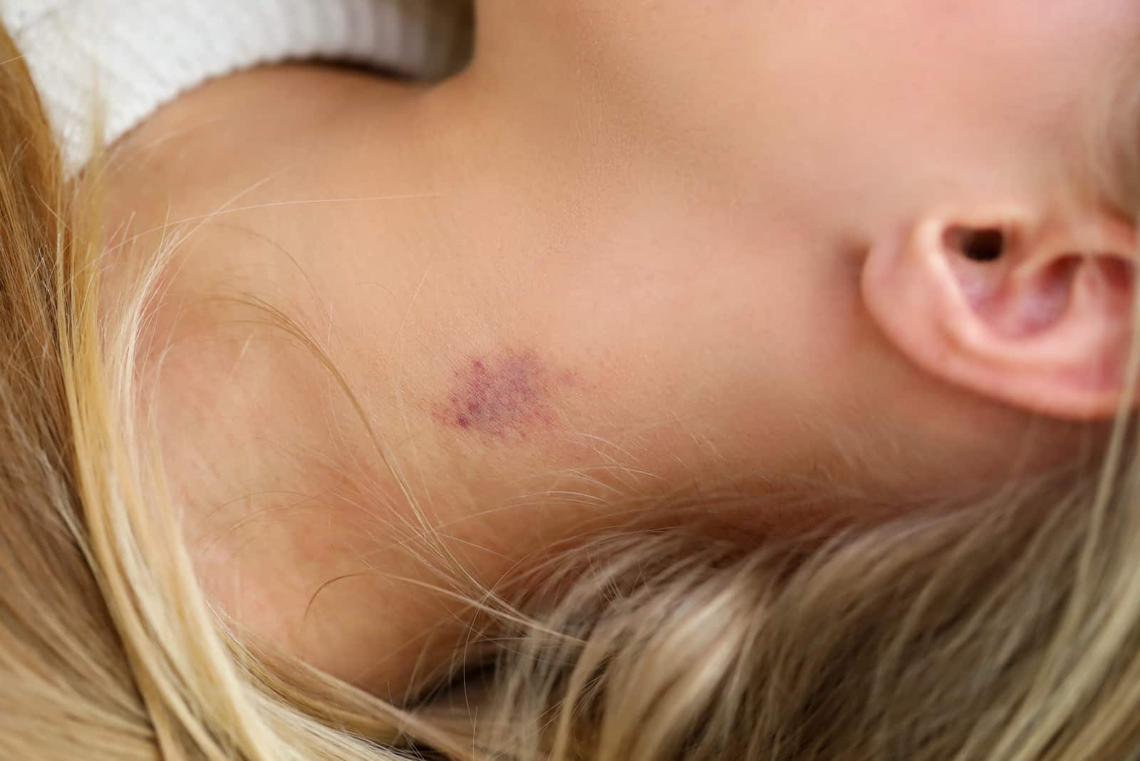 blonde girl with a hickey