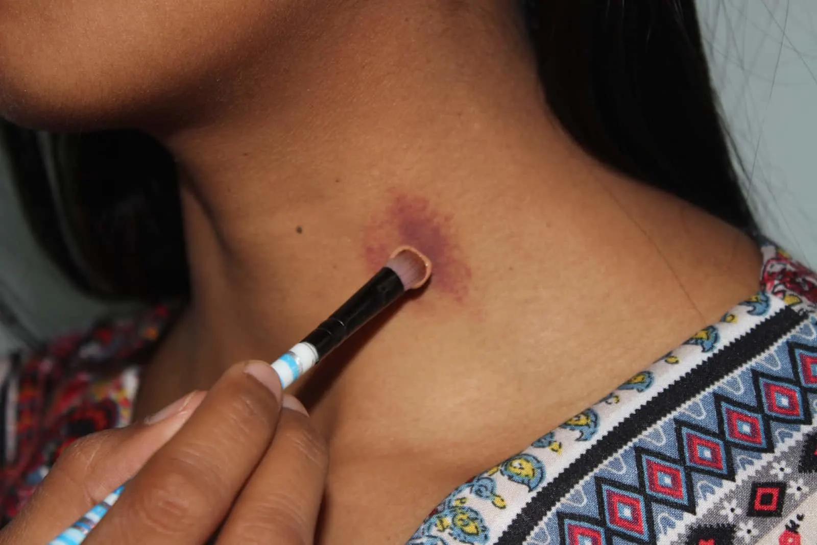 girl covering hickey with foundation
