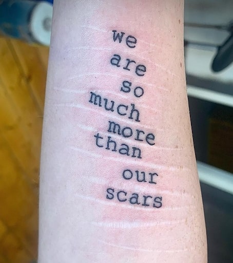 We are so much more than our scars 