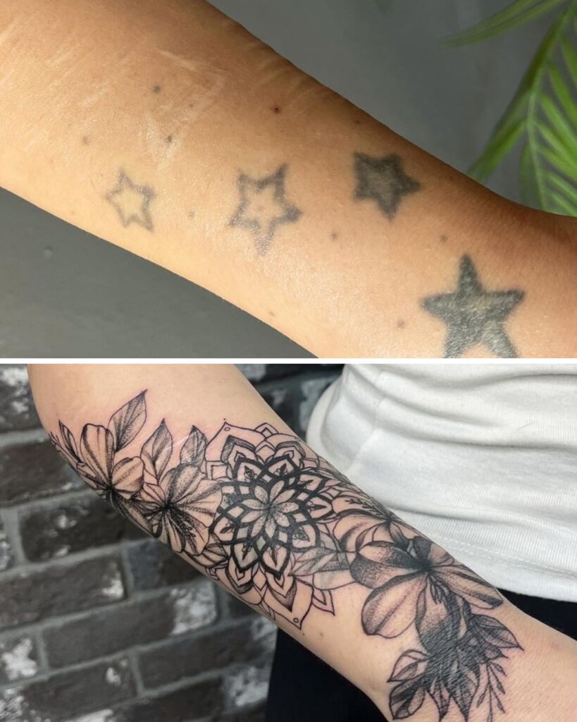 Floral Mandala Cover-Up Tattoo