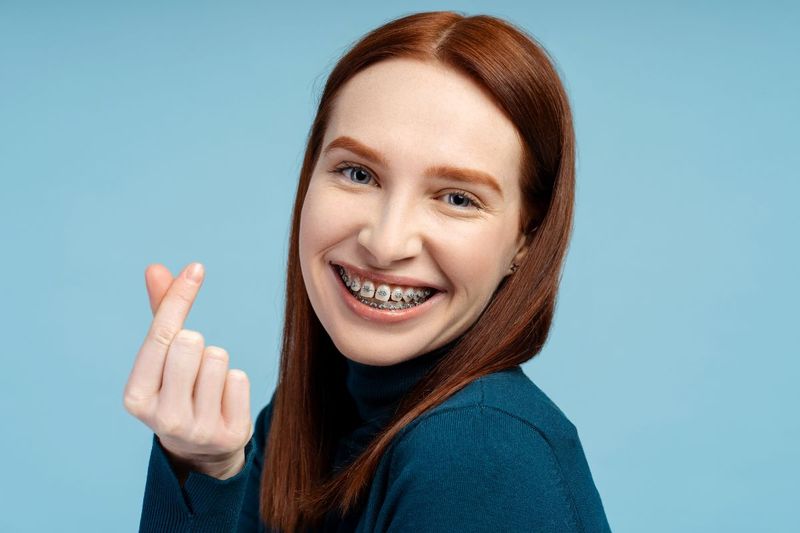 Braces (Orthodontics)