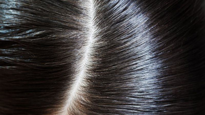 Side Parts