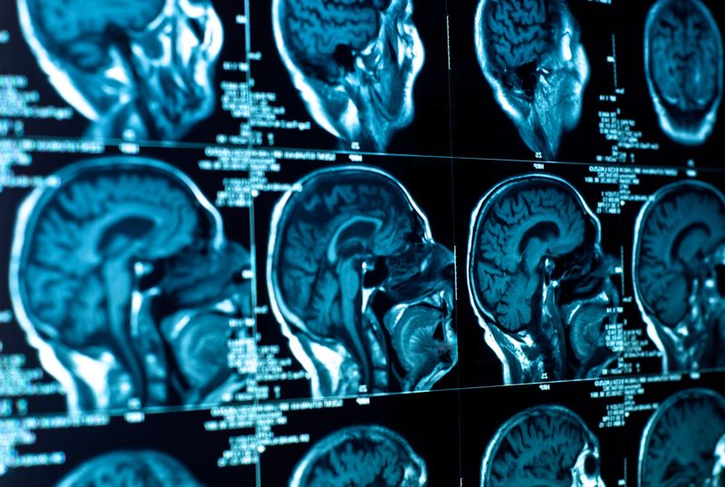 3. Withdrawal: Your Brain on Love Loss
